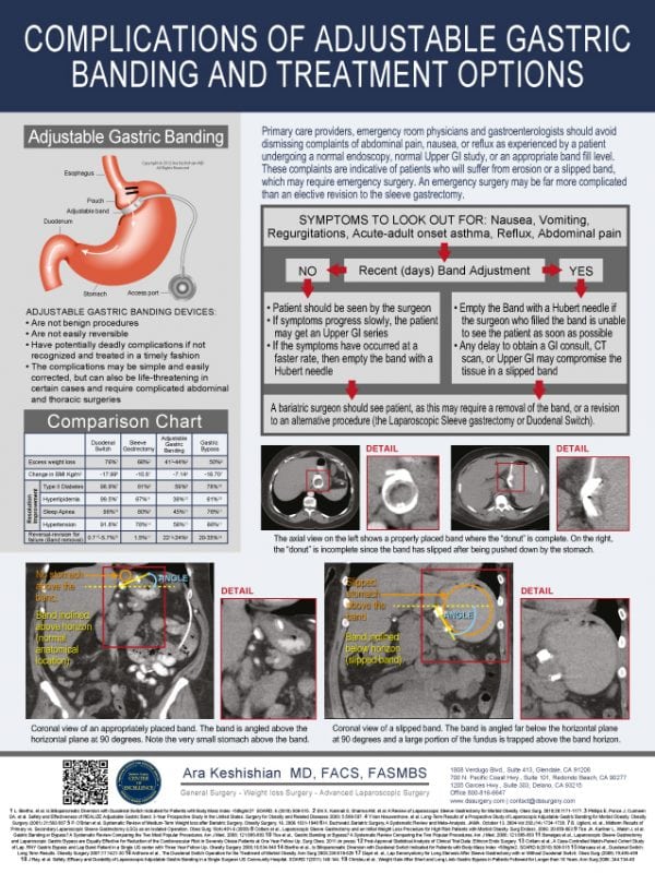 Complications of Adjustable Gastric Banding - DSSurgery