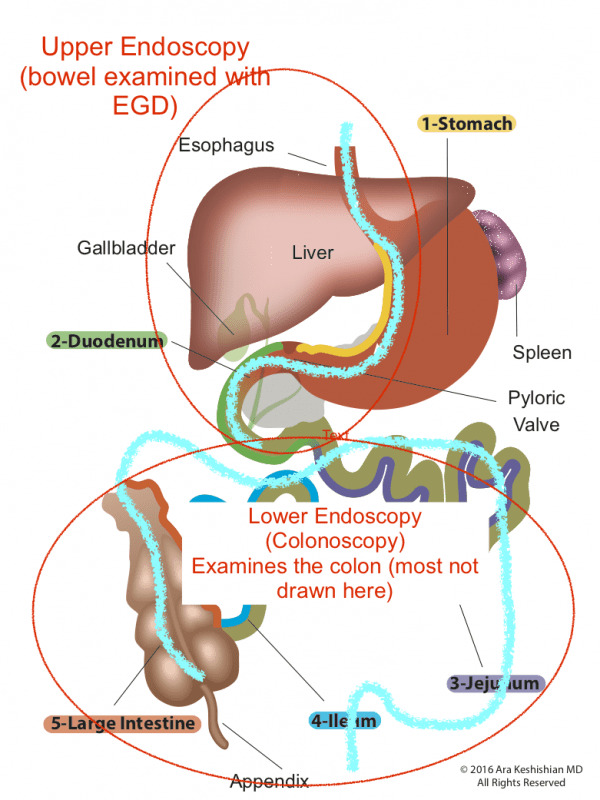 difference-between-colonoscopy-and-sigmoidoscopy-youtube